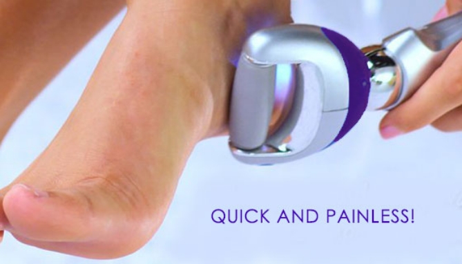 Picture 7 of PedEgg Powerball Pivoting Callus Remover (Deluxe Kit)